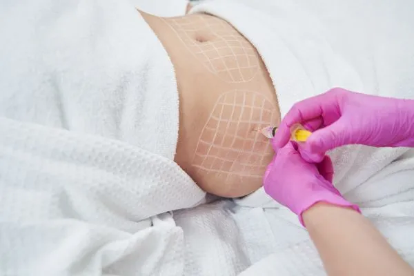 image of fat dissolving injections on love handles to help combat weight gain Ross-on-Wye