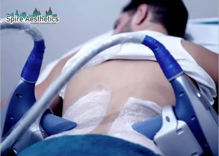 Man having fat freezing treatment done on love handles before a competitions Ross-on-Wye to create a sculpted look.
