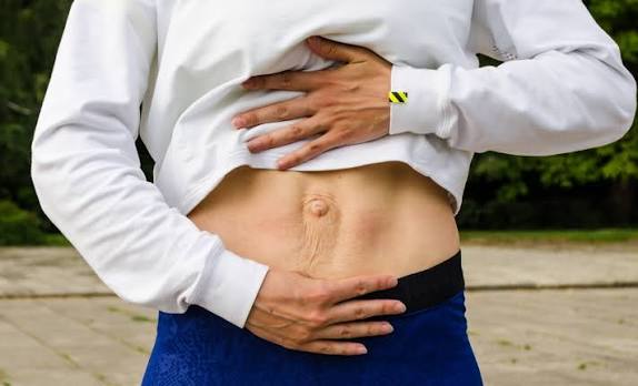 When Could Diastasis Recti Be the Missing Piece of the Puzzle Ross-on-Wye?